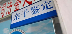 昭通上户口亲子鉴定出结果时间【在线咨询】