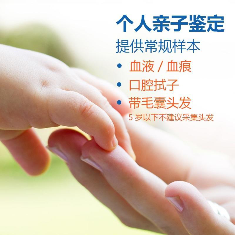 昭通头发能办理亲子鉴定吗,匿名亲子鉴定价格
