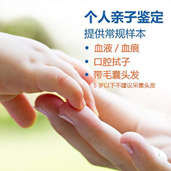 昭通头发能办理亲子鉴定吗，匿名亲子鉴定价格